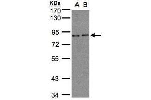 WB Image Sample(30 ug whole cell lysate) A:A431, B:H1299 7. (ZER1 antibody  (C-Term))