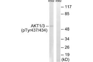 Western blot analysis of extracts from K562 cells, treated with insulin (0. (AKT1/3 (pTyr437) antibody)