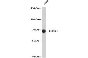 Western blot analysis of extracts of Jurkat cells using CCDC61 Polyclonal Antibody at dilution of 1:1000. (CCDC61 antibody)