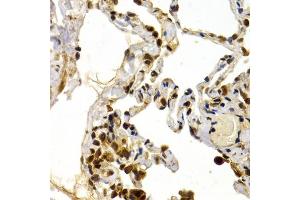 Immunohistochemistry of paraffin-embedded human lung using DP1/DP1/TFDP1 antibody (ABIN6130313, ABIN6149038, ABIN6149040 and ABIN6221075) at dilution of 1:200 (40x lens). (DP1 antibody  (AA 1-290))
