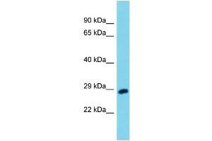 Host: Rabbit Target Name: Uchl3 Sample Type: Mouse Testis lysates Antibody Dilution: 1.
