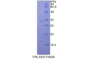 SDS-PAGE (SDS) image for Myosin IB (MYO1B) (AA 779-1040) protein (His tag) (ABIN1877565) (Myosin IB Protein (MYO1B) (AA 779-1040) (His tag))