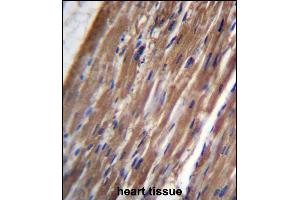 FBLIM1 Antibody (C-term) (ABIN656647 and ABIN2845889) immunohistochemistry analysis in formalin fixed and paraffin embedded human heart tissue followed by peroxidase conjugation of the secondary antibody and DAB staining. (FBLIM1 antibody  (C-Term))