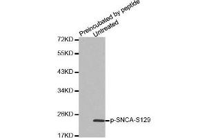 Western Blotting (WB) image for anti-Synuclein, alpha (SNCA) (pSer129) antibody (ABIN1682058) (SNCA antibody  (pSer129))