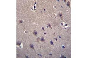 Immunohistochemistry (Paraffin-embedded Sections) (IHC (p)) image for anti-MCF.2 Cell Line Derived Transforming Sequence (MCF2) (AA 803-833), (C-Term) antibody (ABIN953349)