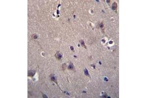 Immunohistochemistry analysis in formalin fixed and paraffin embedded human brain tissue reacted with MCF2 Antibody (C-term) followed which was peroxidase conjugated to the secondary antibody and followed by DAB staining. (MCF2 antibody  (C-Term))