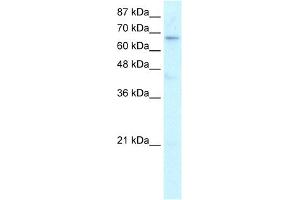 WB Suggested Anti-HR Antibody Titration:  0. (Hairless antibody  (N-Term))