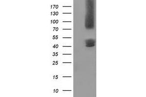 Western Blotting (WB) image for anti-Gephyrin (GPHN) antibody (ABIN1498424)