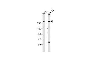All lanes : Anti-NBAS Antibody (N-Term) at 1:2000 dilution Lane 1: A431 whole cell lysate Lane 2: U-2OS whole cell lysate Lysates/proteins at 20 μg per lane. (NBAS antibody  (AA 628-661))