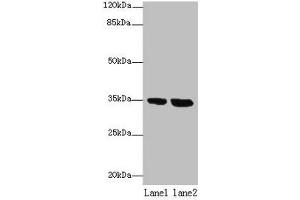 Western blot All lanes: TMEM165 antibody at 8 μg/mL Lane 1: Jurkat whole cell lysate Lane 2: Hela whole cell lysate Secondary Goat polyclonal to rabbit IgG at 1/10000 dilution Predicted band size: 35, 29 kDa Observed band size: 35 kDa (TMEM165 antibody  (AA 173-228))