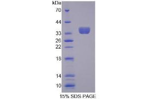 Image no. 1 for Transcription Elongation Factor A (SII), 3 (TCEA3) (AA 59-347) protein (His tag) (ABIN5665201) (TCEA3 Protein (AA 59-347) (His tag))