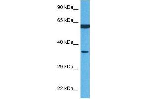 Host:  Rabbit  Target Name:  P4HB  Sample Tissue:  Human MCF7 Whole Cell  Antibody Dilution:  1ug/ml (P4HB antibody  (N-Term))