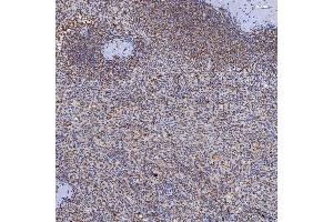 IHC analysis of TRMT61A using anti-TRMT61A antibody (ABIN7599220). (TRMT61A antibody  (AA 1-289))