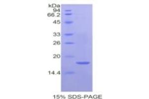SDS-PAGE of Protein Standard from the Kit  (Highly purified E. (Hemopexin ELISA Kit)