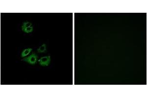 Immunofluorescence analysis of A549 cells, using CCBP2 Antibody. (CCBP2 antibody  (AA 335-384))