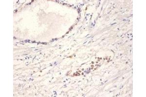 Immunohistochemistry of paraffin-embedded human prostate tissue using ABIN7161468 at dilution of 1:100 (Neurotrophin 4 antibody  (AA 82-210))