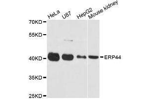 Western blot analysis of extracts of various cell lines, using ERP44 antibody (ABIN5972576) at 1:3000 dilution. (ERP44 antibody)