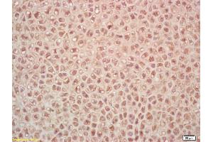 Formalin-fixed and paraffin embedded mouse embryo labeled with Rabbit Anti PAK7/PAK5/MBT Polyclonal Antibody, Unconjugated (ABIN671496) at 1:200 followed by conjugation to the secondary antibody and DAB staining (PAK7 antibody  (AA 621-719))