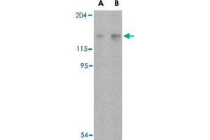 Western blot analysis of Rptor in L1210 cell lysate with Rptor polyclonal antibody  at (A) 2 and (B) 4 ug/mL .