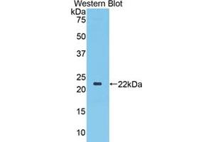 Western blot analysis of the recombinant protein. (TLR3 antibody  (AA 533-705))