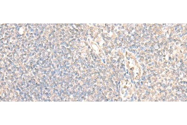 PARS2 antibody