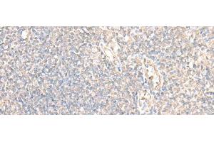 Immunohistochemistry of paraffin-embedded Human tonsil tissue using PARS2 Polyclonal Antibody at dilution of 1:30(x200) (PARS2 antibody)
