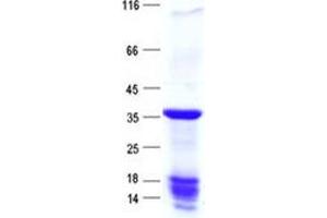 Western Blotting (WB) image for Family with Sequence Similarity 221, Member A (FAM221A) protein (His tag) (ABIN2720775)