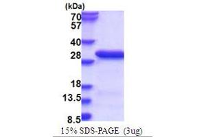 SDS-PAGE (SDS) image for RAN Binding Protein 3 (RANBP3) (AA 235-445) protein (His tag) (ABIN5853748)