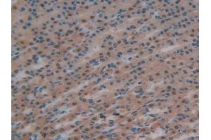 Detection of GR in Rat Stomach Tissue using Polyclonal Antibody to Glutathione Reductase (GR) (Glutathione Reductase antibody  (AA 7-246))