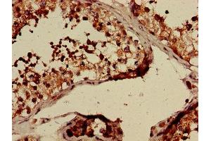 Immunohistochemistry of paraffin-embedded human testis tissue using ABIN7147850 at dilution of 1:100 (CLTCL1 antibody  (AA 1423-1566))
