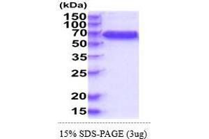 SDS-PAGE (SDS) image for Interleukin 10 Receptor, beta (IL10RB) (AA 20-220) protein (hIgG-His-tag) (ABIN5854992) (IL10RB Protein (AA 20-220) (hIgG-His-tag))