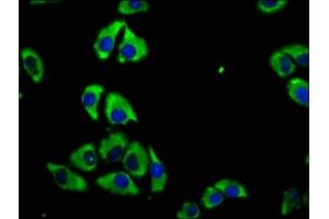 Immunofluorescence staining of A549 cells with ABIN7147182 at 1:100, counter-stained with DAPI. (CD82 antibody  (AA 111-228))