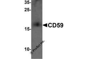 Western Blotting (WB) image for anti-CD59 (CD59) (N-Term) antibody (ABIN1077443) (CD59 antibody  (N-Term))