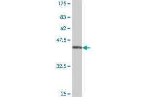 Western Blot detection against Immunogen (38. (ETV1 antibody  (AA 148-257))