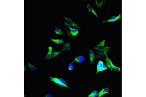 Immunofluorescent analysis of Hela cells using ABIN7173643 at dilution of 1:100 and Alexa Fluor 488-congugated AffiniPure Goat Anti-Rabbit IgG(H+L) (Tuberin antibody  (AA 1396-1496))