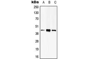 Western blot analysis of PSKH2 expression in Hela (A), HEK293T (B), mouse brain (C) whole cell lysates. (PSKH2 antibody  (Center))