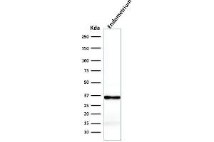 Western Blot Analysis of Endometrium lysate using Calponin-1 Recombinant Mouse Monoclonal Antibody (rCNN1/832). (Recombinant CNN1 antibody)