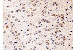 IHC analysis of Kinectin 1/KTN1 using anti-Kinectin 1/KTN1 antibody (ABIN7601096). (KTN1 antibody  (AA 283-827))