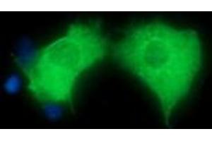 Image no. 1 for anti-Hepatocyte Growth Factor-Regulated tyrosine Kinase Substrate (HGS) antibody (ABIN1498718)