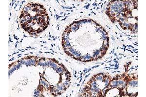 Immunohistochemical staining of paraffin-embedded Human breast tissue using anti-RBBP7 mouse monoclonal antibody.