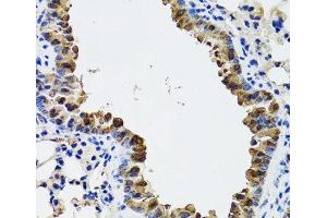 Immunohistochemistry of paraffin-embedded Mouse lung using ESD Polyclonal Antibody at dilution of 1:100 (40x lens).