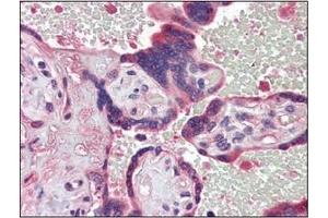Immunohistochemistry (IHC) image for anti-Tyrosyl-DNA Phosphodiesterase 1 (TDP1) (AA 1-298), (N-Term) antibody (ABIN400858) (TDP1 antibody  (N-Term))