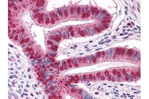 Immunohistochemical analysis of paraffin-embedded human Uterus tissues using MUM1 antibody