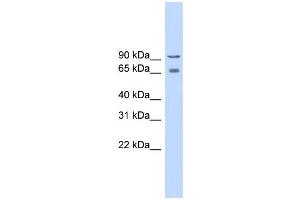 WB Suggested Anti-CACNB2 Antibody Titration:  0. (CACNB2 antibody  (Middle Region))