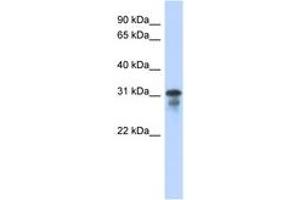 Image no. 1 for anti-Mediator Complex Subunit 6 (MED6) (C-Term) antibody (ABIN6742443) (MED6 antibody  (C-Term))