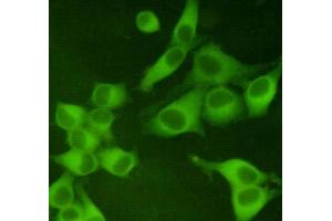 Immunocytochemistry staining of Hela cells fixed with 4 % Paraformaldehyde and using anti-PKM2 mouse mAb (dilution 1:400). (PKM2 antibody)