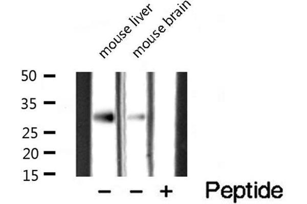 CTDSP1 antibody  (N-Term)