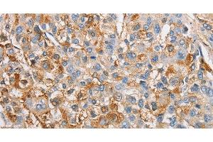 Immunohistochemistry (Paraffin-embedded Sections) (IHC (p)) image for anti-Inhibitor of kappa Light Polypeptide Gene Enhancer in B-Cells, Kinase gamma (IKBKG) antibody (ABIN7235953)