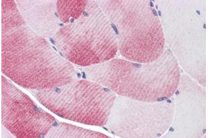 Human Skeletal Muscle: Formalin-Fixed, Paraffin-Embedded (FFPE) (MYBPC1 antibody  (C-Term))