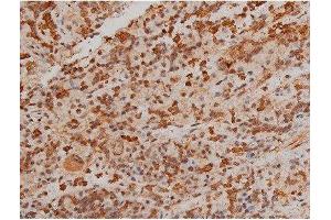 Immunohistochemistry (IHC) image for anti-Filamin A, alpha (FLNA) (pSer2152) antibody (ABIN6256196)